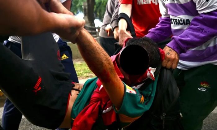 Congreso - Un fotógrafo en grave estado tras ser herido por una granada de gas